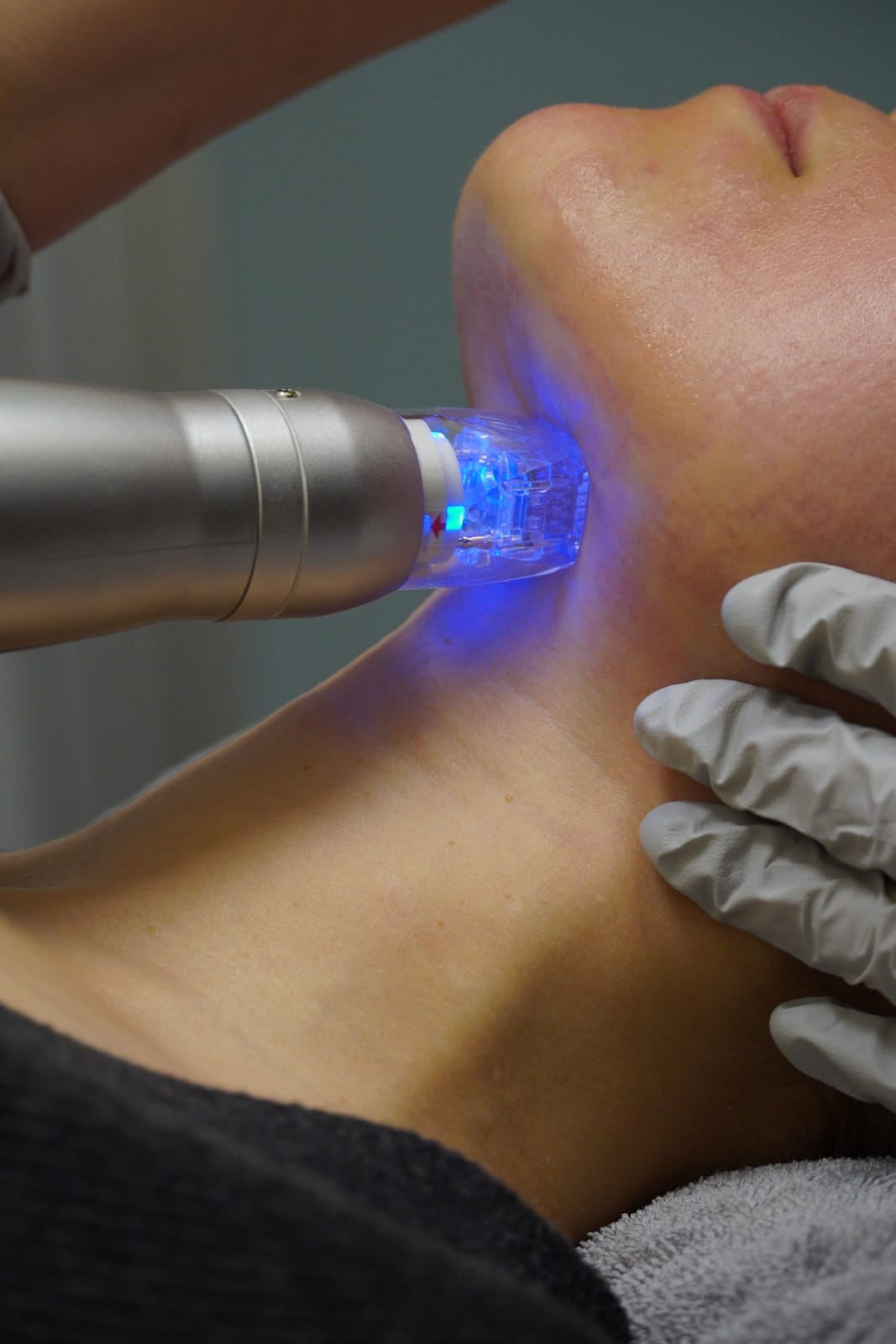 Facial Aging & Sagging treatment at Sun Aesthetic Clinic, Bellevue WA