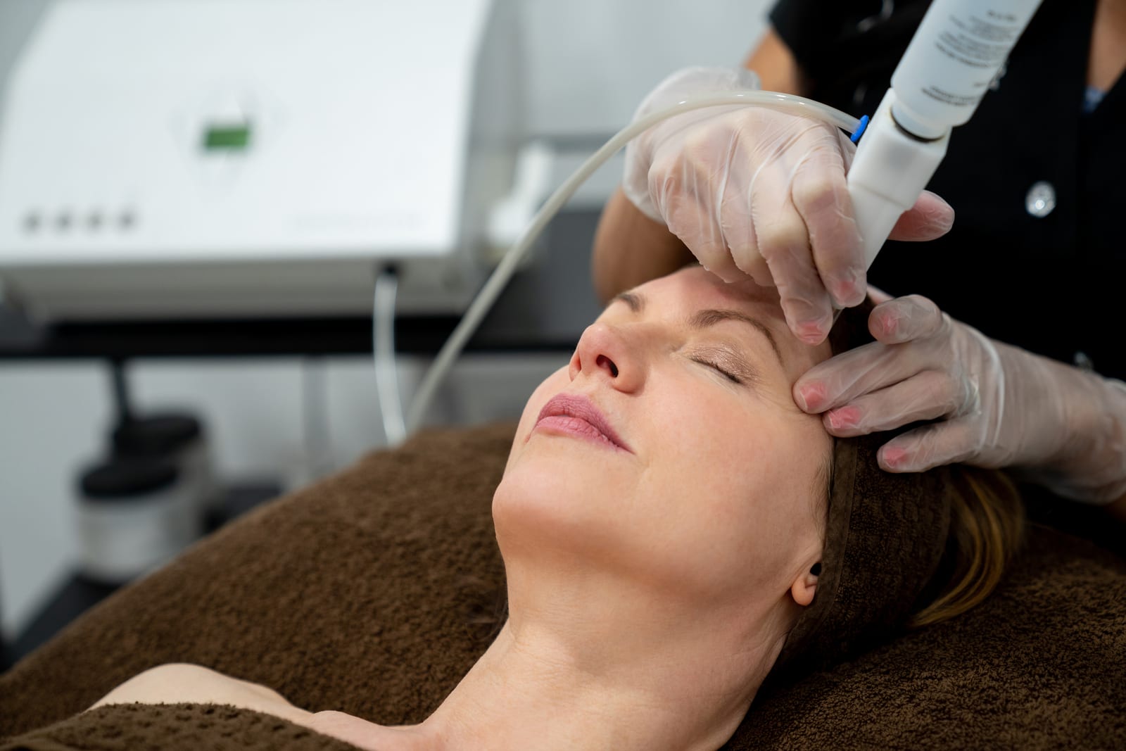 Candela Glace Facial treatment at Sun Aesthetic Clinic, Bellevue WA