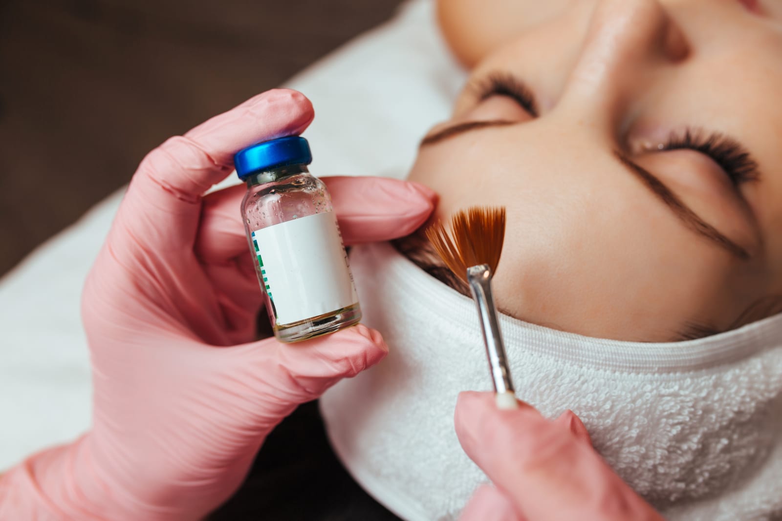 Chemical Peels — Sun Aesthetic Clinic, Bellevue WA