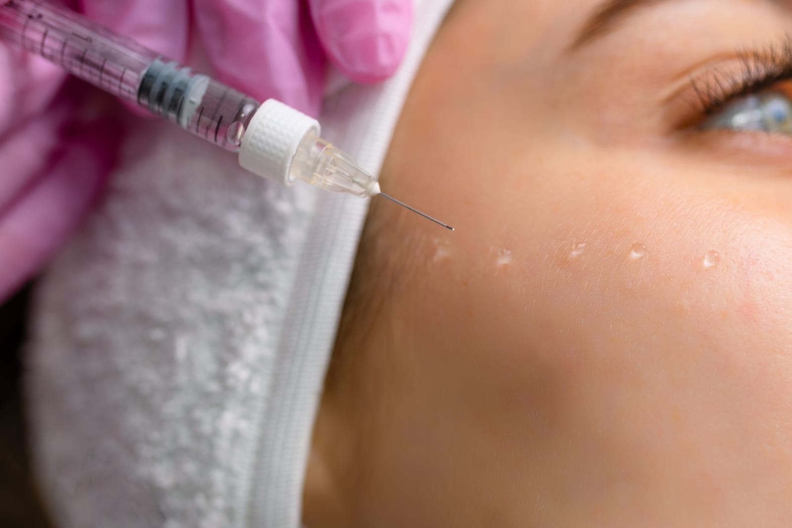 Mesotherapy — Sun Aesthetic Clinic, Bellevue WA