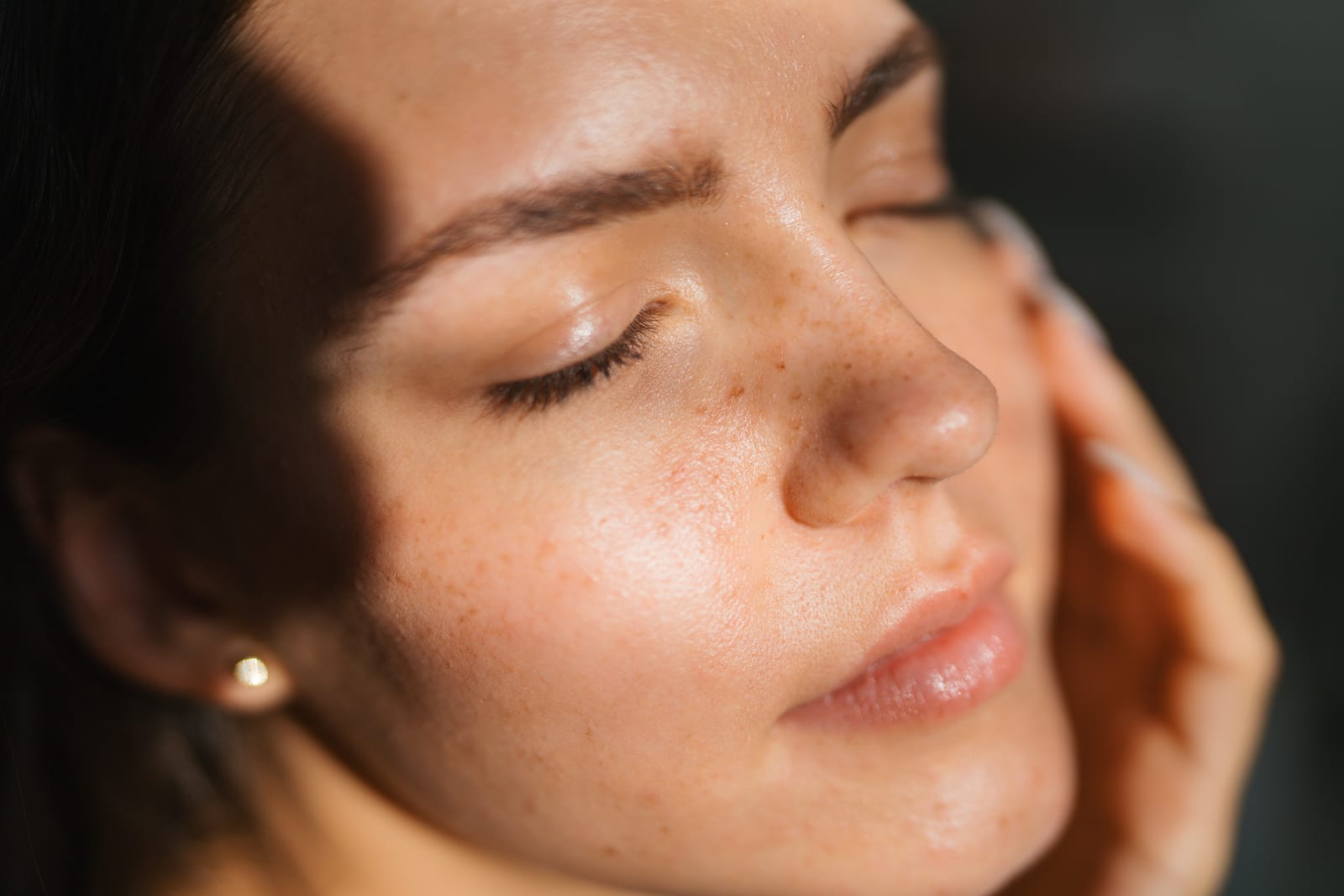Nordlys IPL — Sun Aesthetic Clinic, Bellevue WA