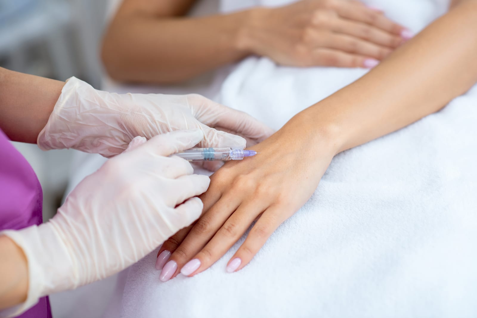 Radiesse treatment at Sun Aesthetic Clinic, Bellevue WA