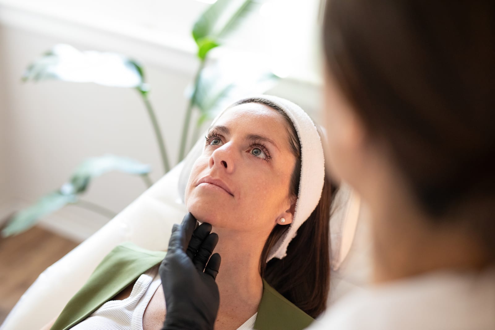 Sun Damage, Melasma & Rosacea treatment at Sun Aesthetic Clinic, Bellevue WA