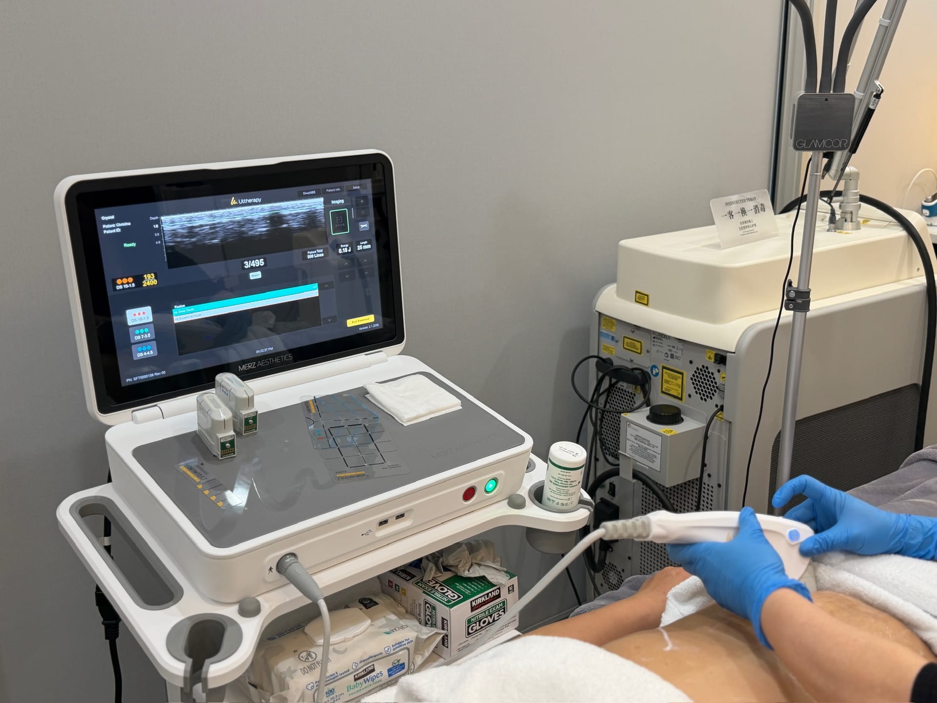 Ultherapy — Sun Aesthetic Clinic, Bellevue WA