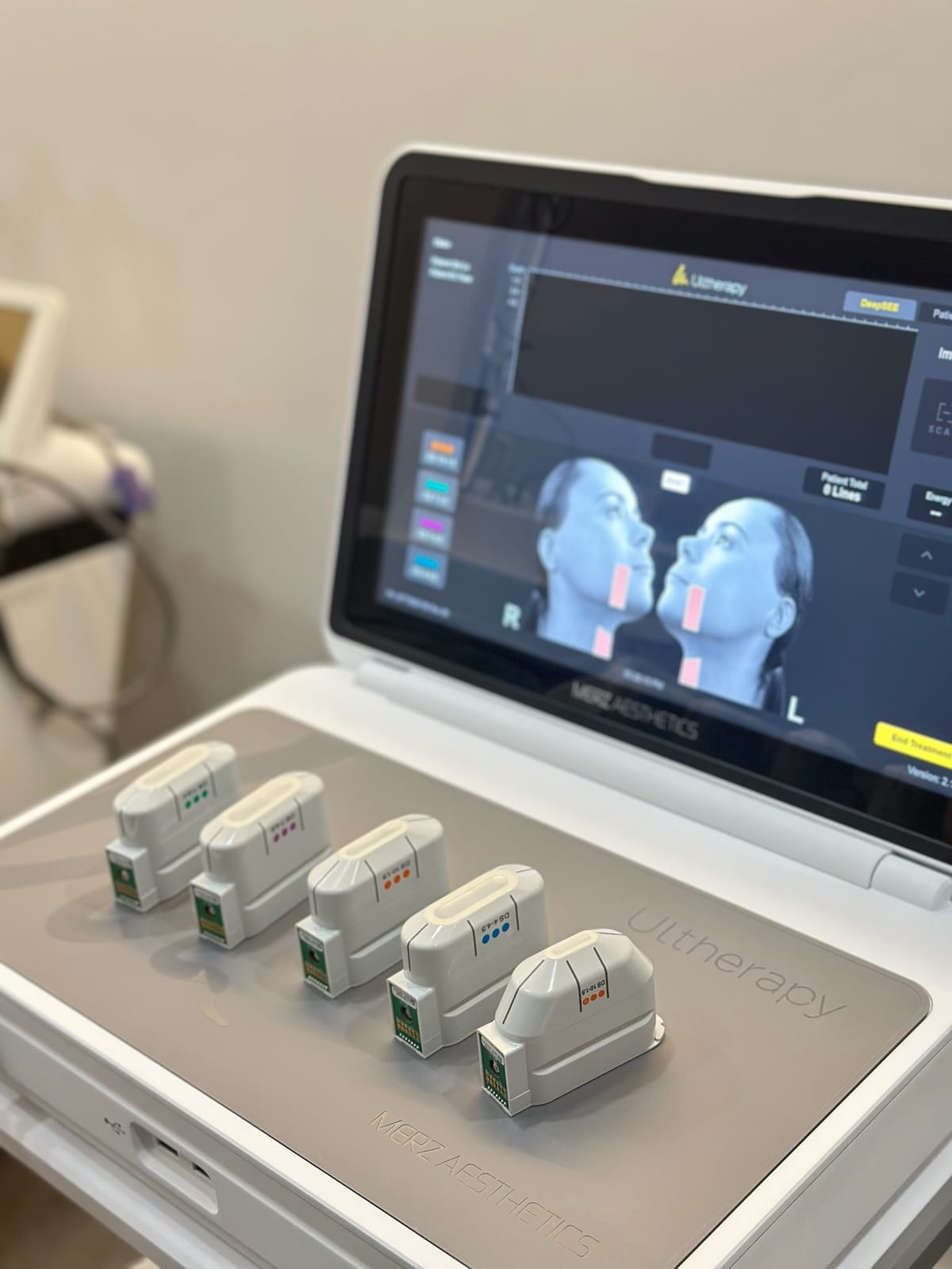Ultherapy treatment at Sun Aesthetic Clinic, Bellevue WA