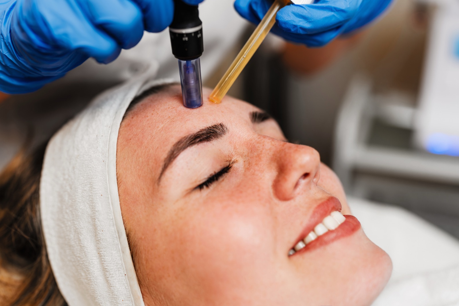 Vampire Facial treatment at Sun Aesthetic Clinic, Bellevue WA